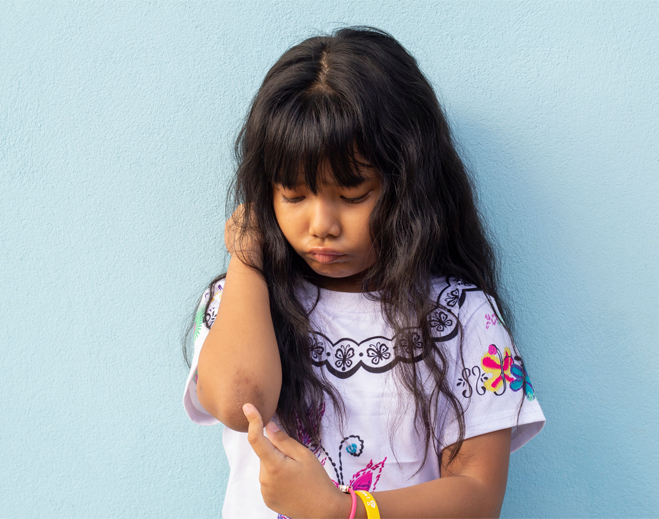 Child examining elbow with minor injury