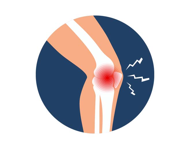 Knee joint pain highlighted in illustration