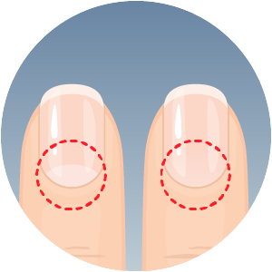 all-tenet-fingernails-clue-300x300-2024-01