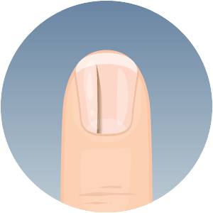 all-tenet-fingernails-clue-300x300-2024-03