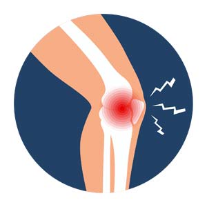 why-does-my-knee-hurt-03 Pain on the inner or outer side of the knee