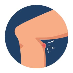 why-does-my-knee-hurt-04 Pain at the back of the knee