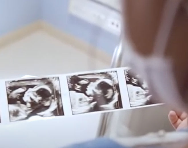 Fetal ultrasound images held during exam