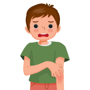 Itchy or Irritated Skin