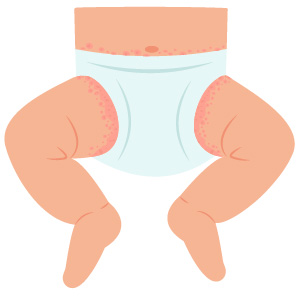 Moisture-Related Triggers
