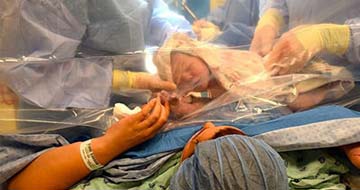 c-section-elizabeth