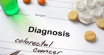 colon-cancer-risks-360x190-thumbnail-our-stories